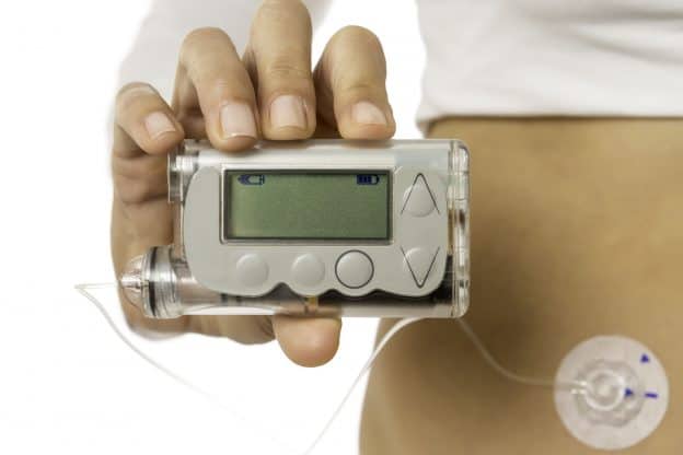 Insulin Pump Vs Injections Whats The Difference Which Is Better 