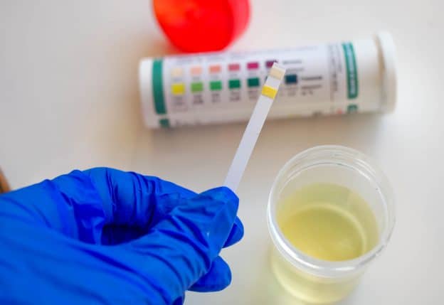 Keto Strips Turning Gray? Here’s Why and What It Means - Prescription Hope