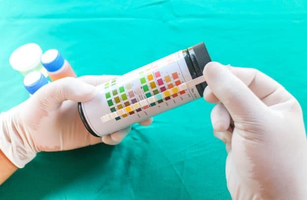 Keto Strips Turning Gray? Here’s Why and What It Means - Prescription Hope