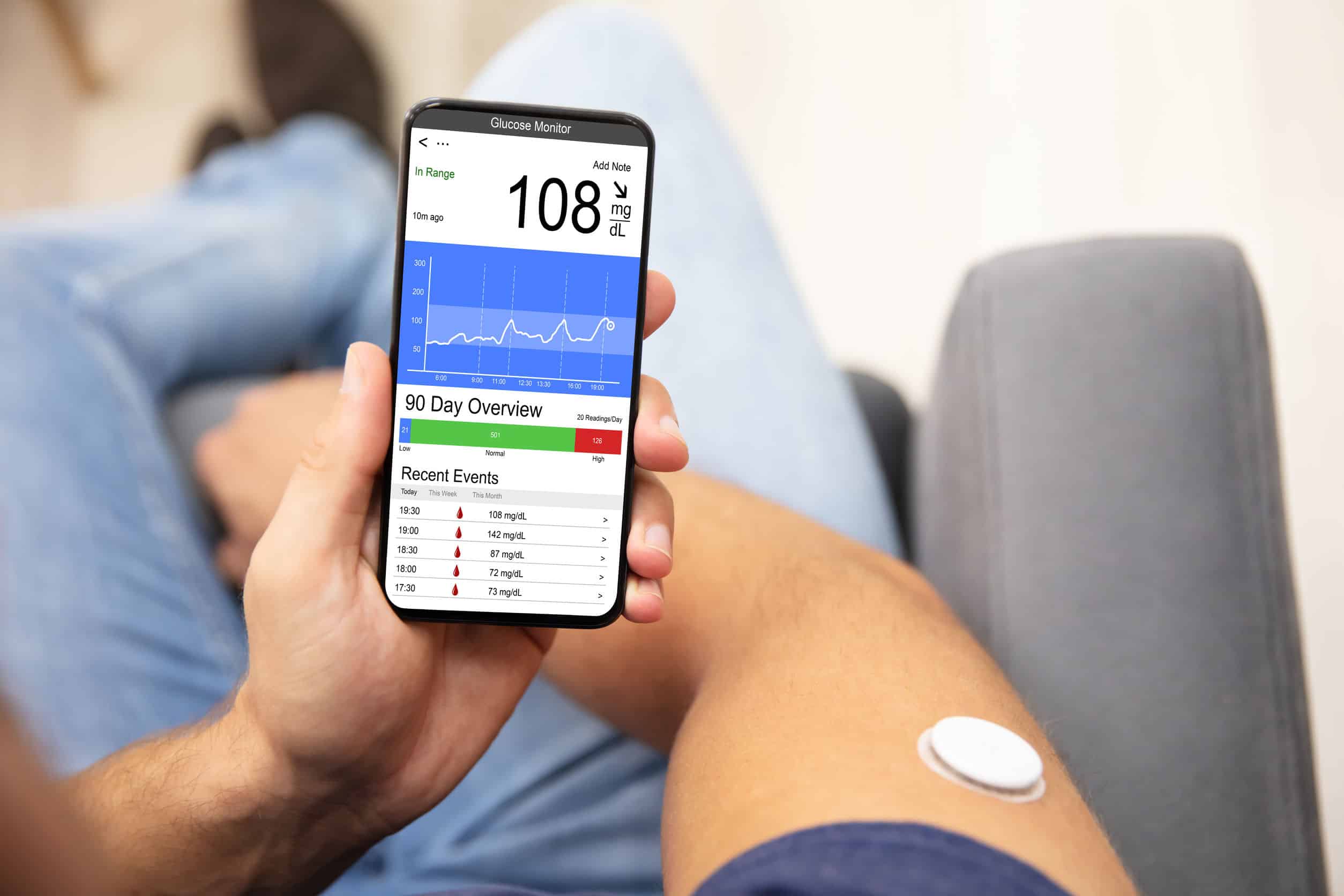 continuous glucose monitor otc