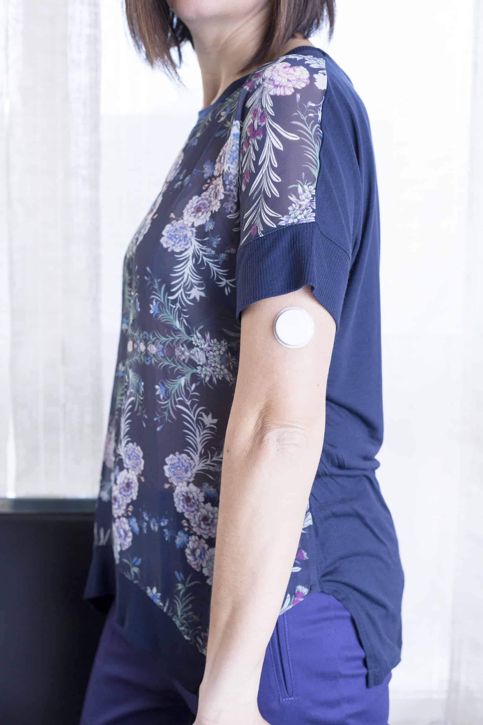 Cgm Device Skin Irritation photo