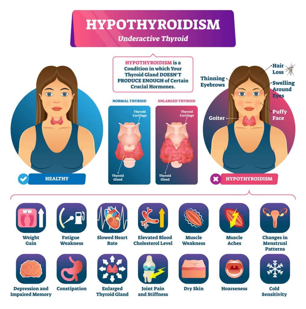 What Problems Can Hypothyroidism Cause