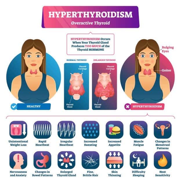 Function of the Thyroid Gland - Overview, Problems, Symptoms, Treatment