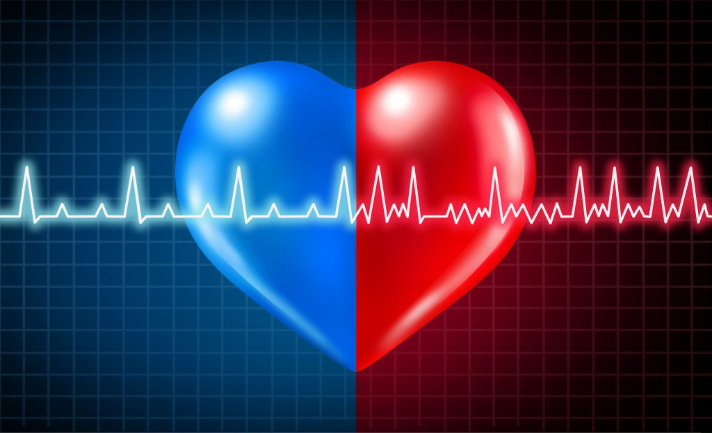 What is Atrial Fibrillation