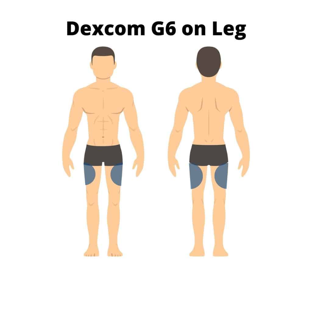 dexcom g6 spots