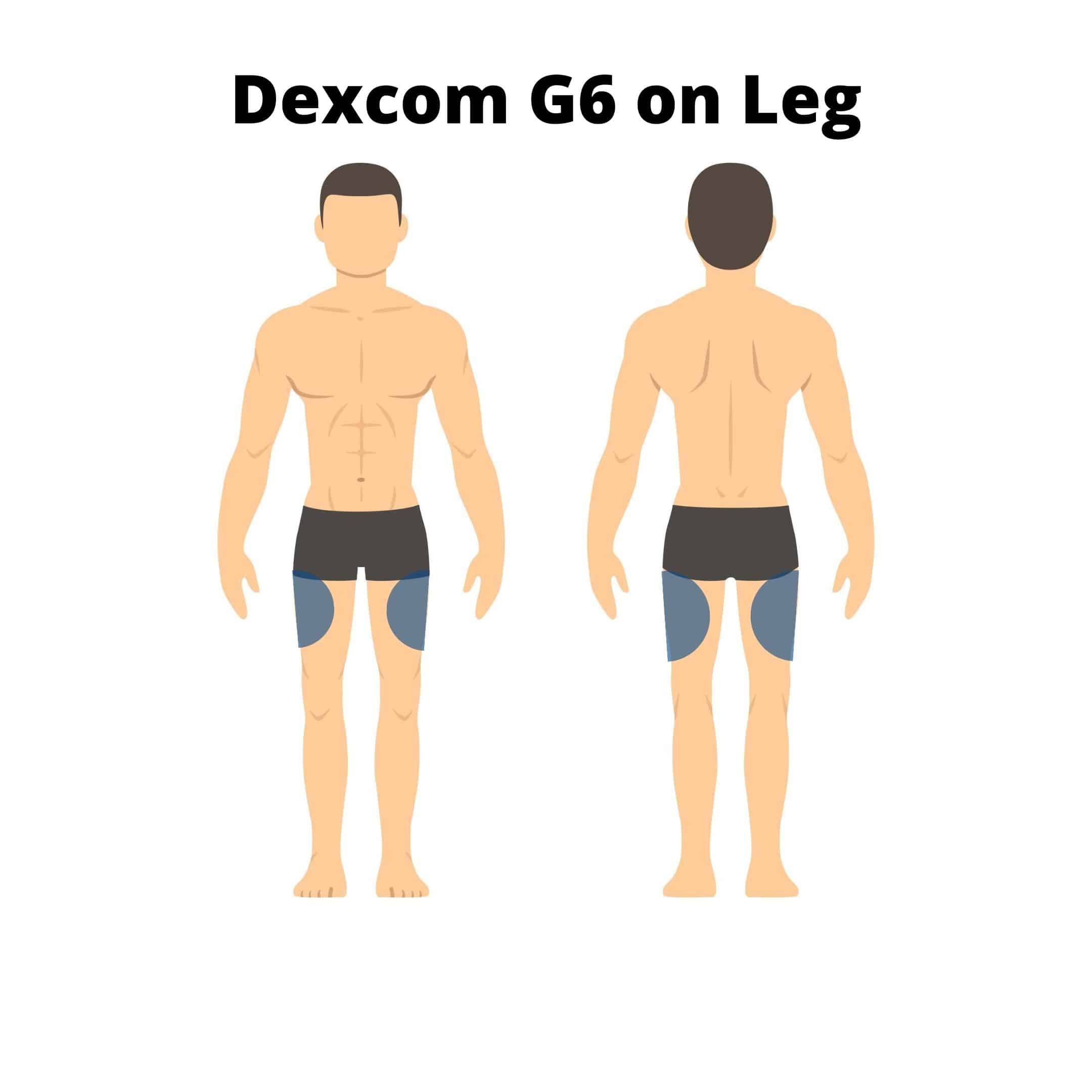 best place for dexcom sensor