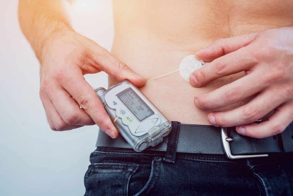 How Long Can You Disconnect an Insulin Pump For