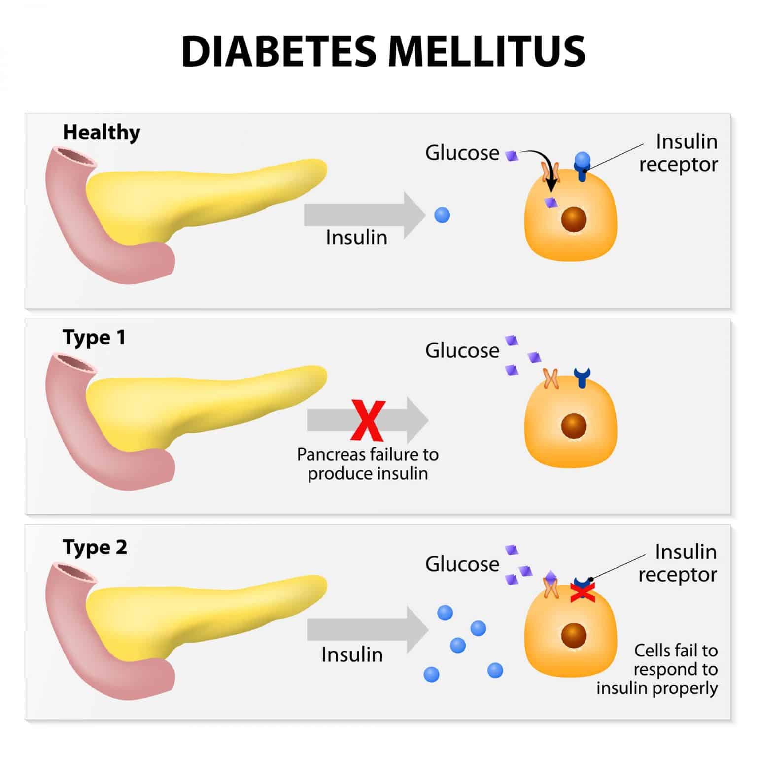 does-the-pancreas-produce-insulin-what-the-pancreas-does