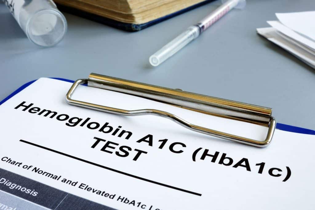 Clipboard with hemoglobin a1c test. This test helps after you learn when to test for diabetes.