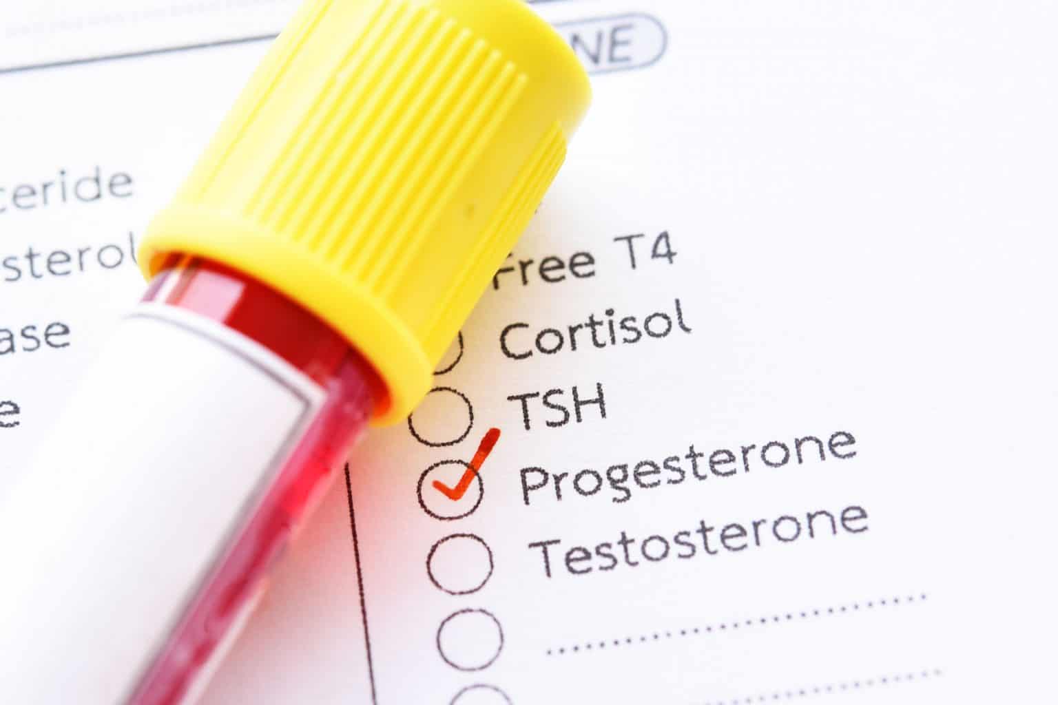 Do Men Have Progesterone? Here’s How It Affects Men