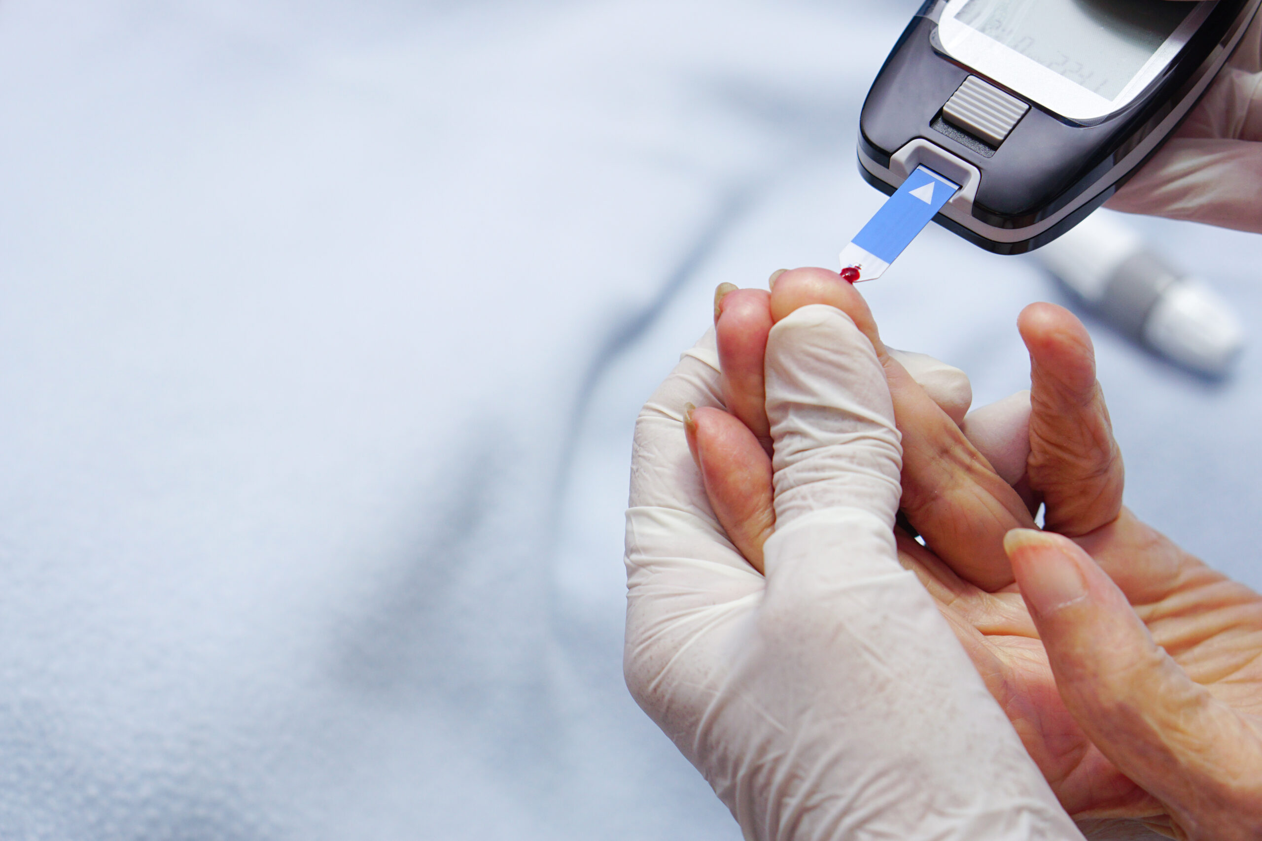 Blood test for diabetes screening