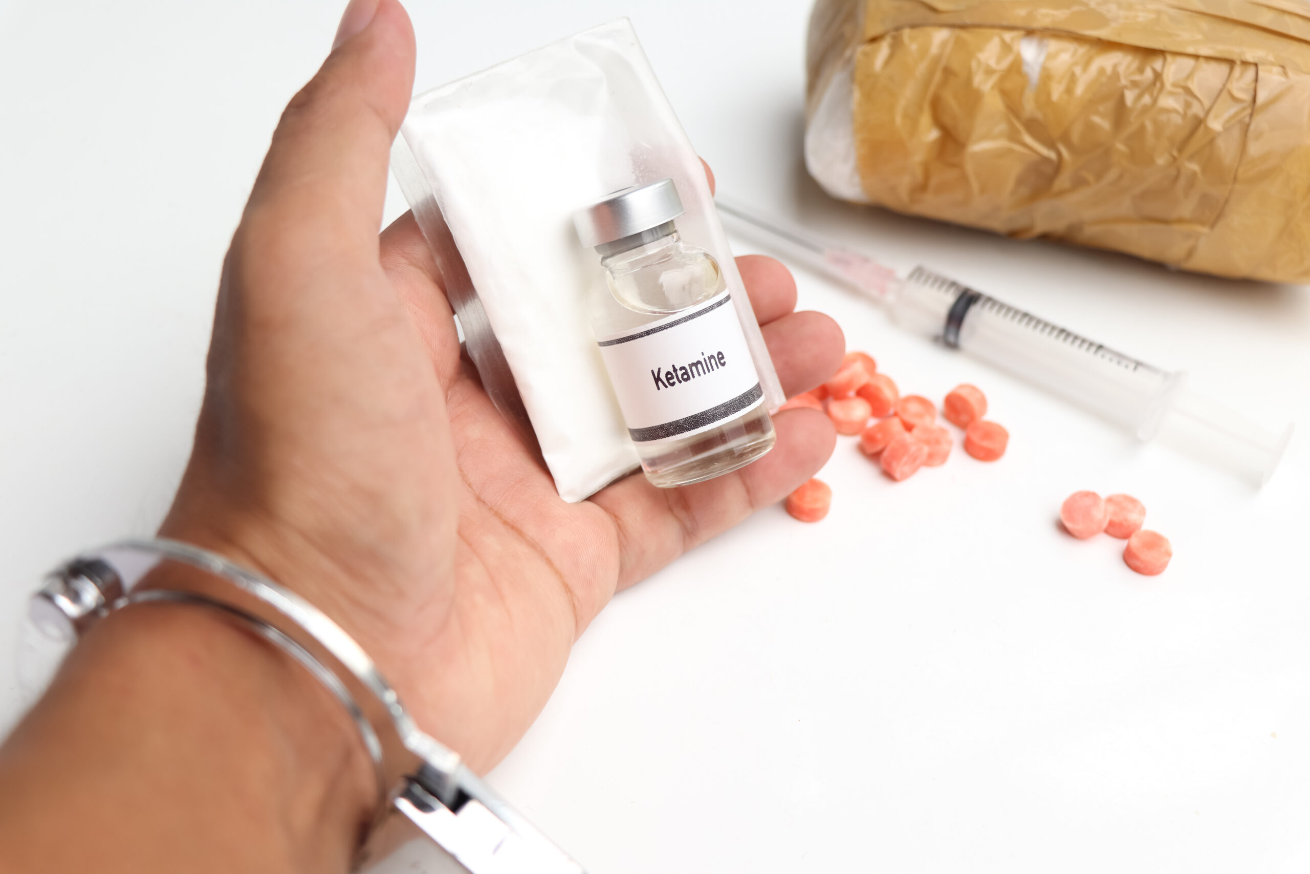 Ketamine therapy for treatment-resistant depression