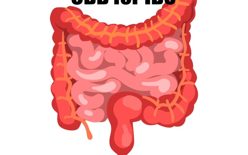 CBD-for-IBS