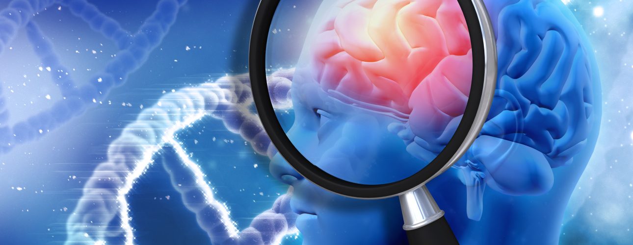 3D medical background with magnifying glass examining brain depicting alzheimers research