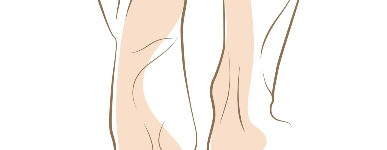 Woman foot sketch, drawn in vector lines