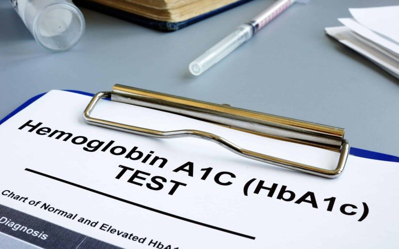 Hemoglobin A1C HbA1c Test form on desk.