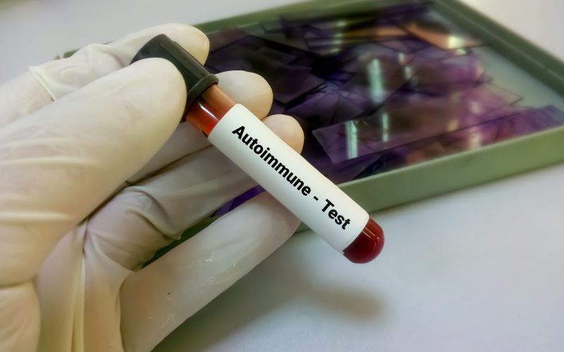Early signs of autoimmune disease