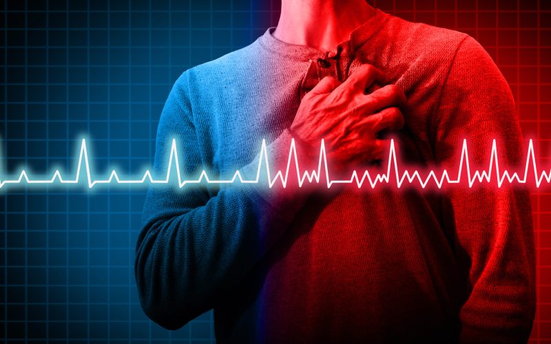 Eliquis for AFib stroke prevention